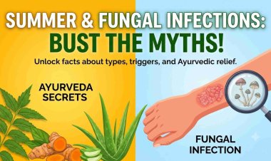 Summer & Fungal Infection! Unlock the myths with Ayurveda